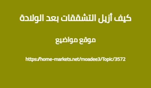 كيف أزيل التشققات بعد الولادة