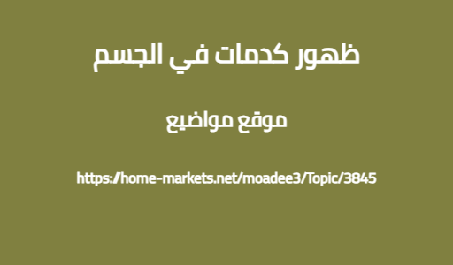 ظهور كدمات في الجسم